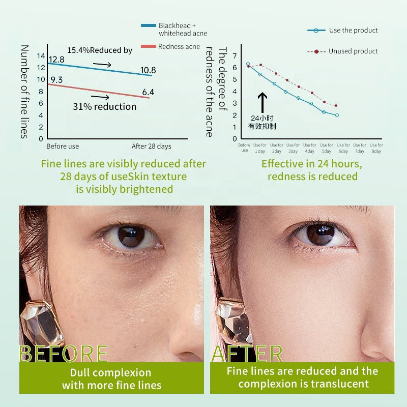 OEM Sale Skincare 6 Pcs Kit Cordyceps Sinensis Herbal Skin Care AHA Facial Care Wholesale Stock